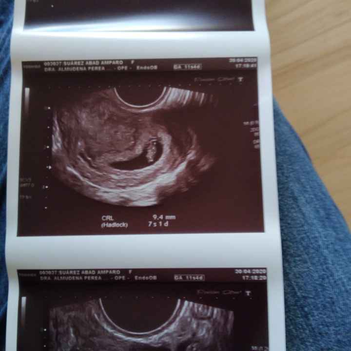 Futuras mamas Diciembre 2020 - 1