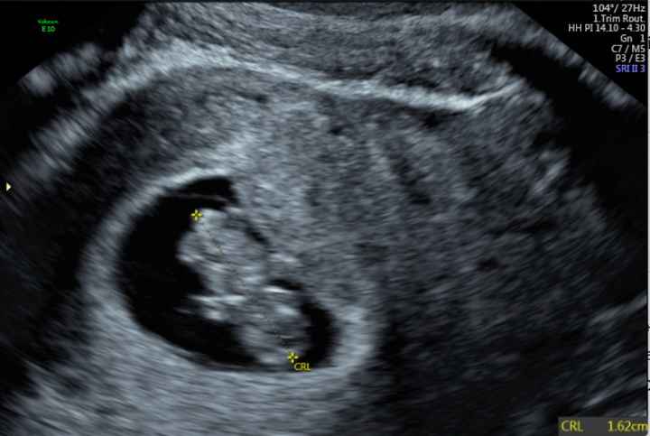 Futuras mamas noviembre 2020 - 1