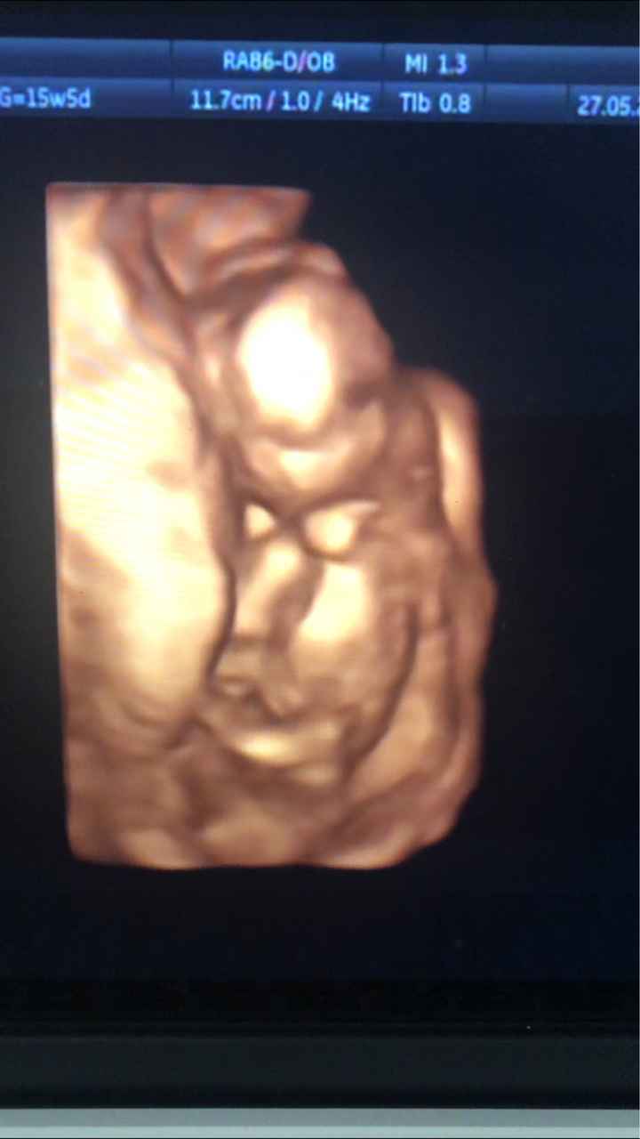 Futuras mamas noviembre 2020 - 1