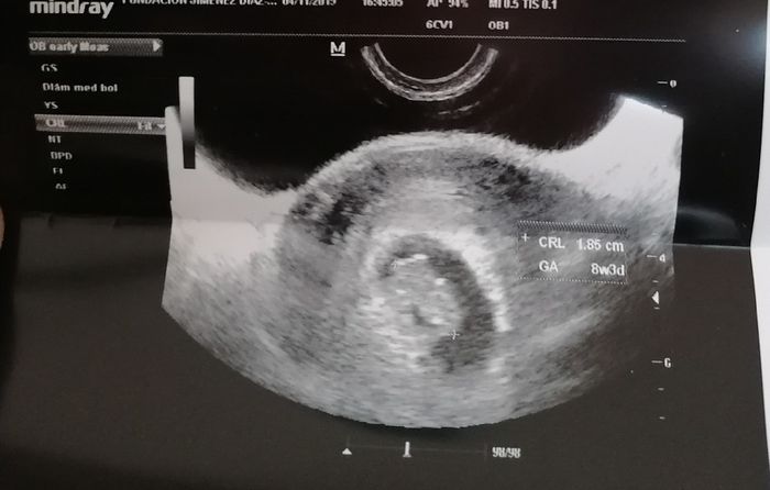 Futuras mamás Junio 2020 - 1