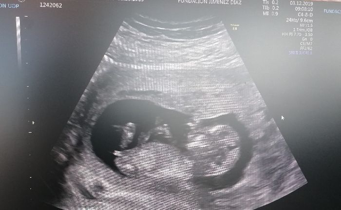Futuras mamás Junio 2020 - 1