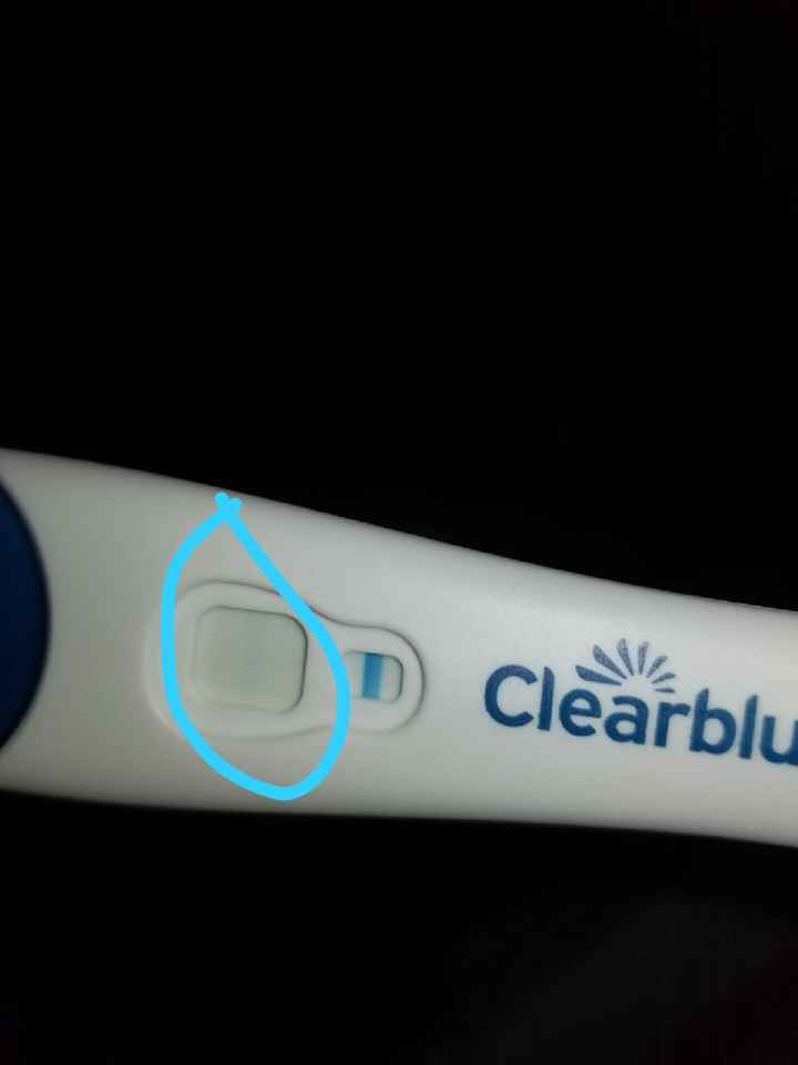 Sangrado de implantacion? - 1