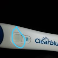 Sangrado de implantacion? - 1