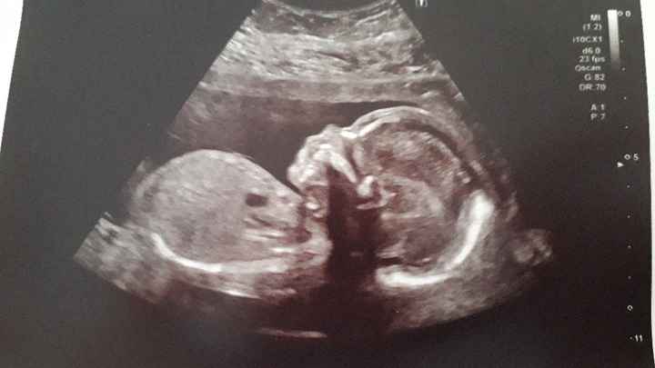 Futuras mamis Febrero 2021 - 1