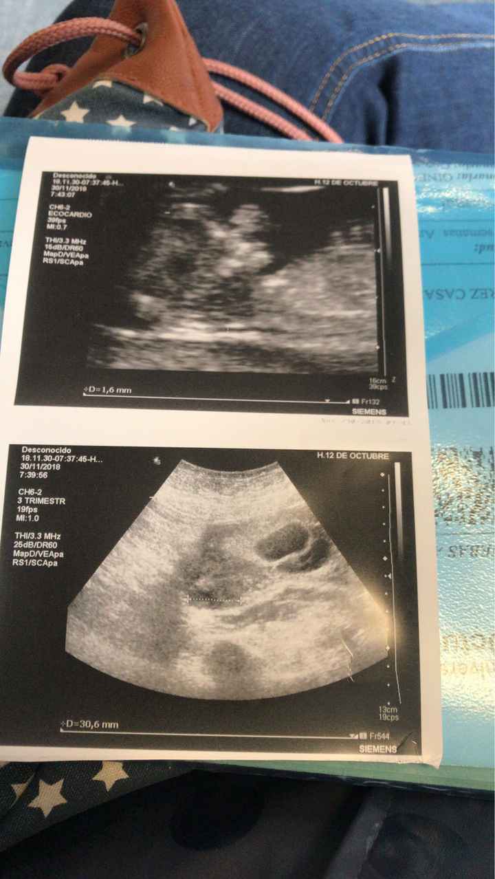 Futuras mamás Junio 2019 - 1
