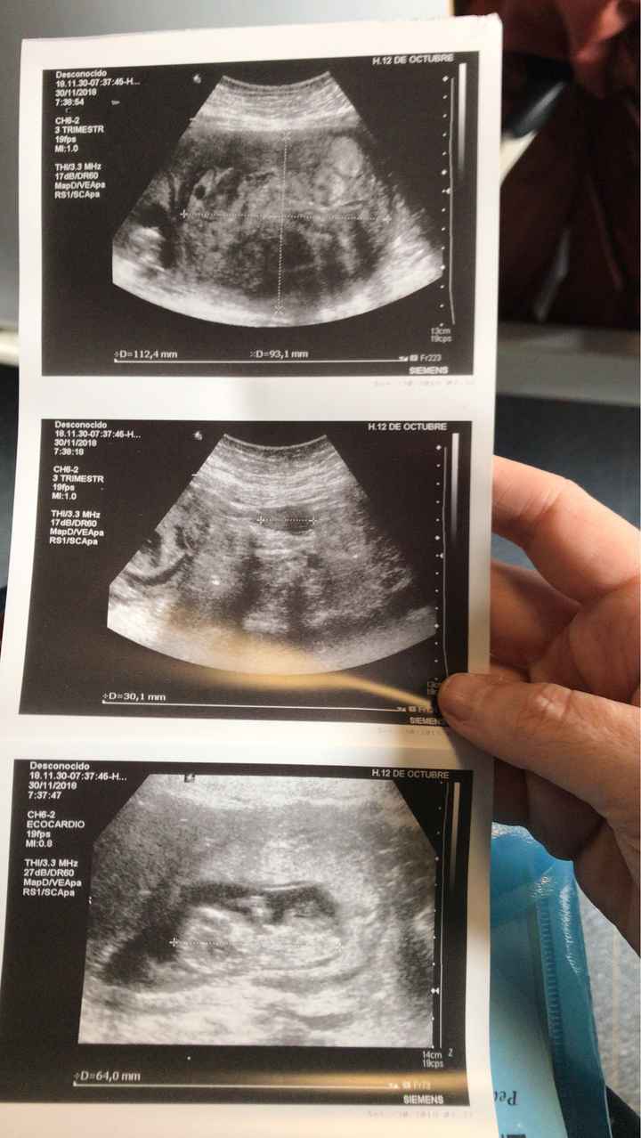 Futuras mamás Junio 2019 - 2