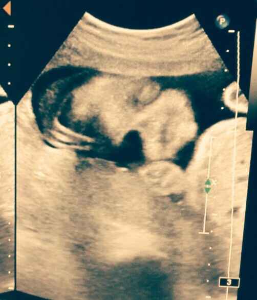 Futuras mamás abril 2017 - 1