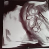 Futuras mamis junio 2021 🤰🏻❤️ oficial - 1