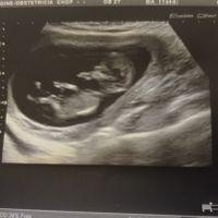 Futuras mamis junio 2021 🤰🏻❤️ oficial - 1