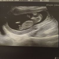 Futuras mamis junio 2021 🤰🏻❤️ oficial - 1