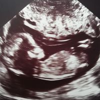 Futuras mamás Septiembre 2020 - 1