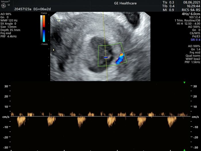 👶🏻futuras mamis febrero 2022👶🏻 - 1