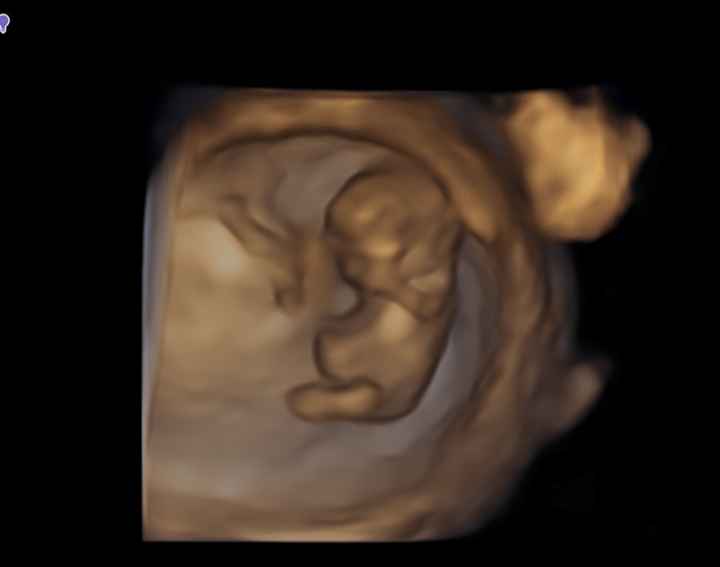 👶🏻futuras mamis febrero 2022👶🏻 - 1