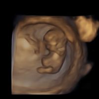 👶🏻futuras mamis febrero 2022👶🏻 - 1