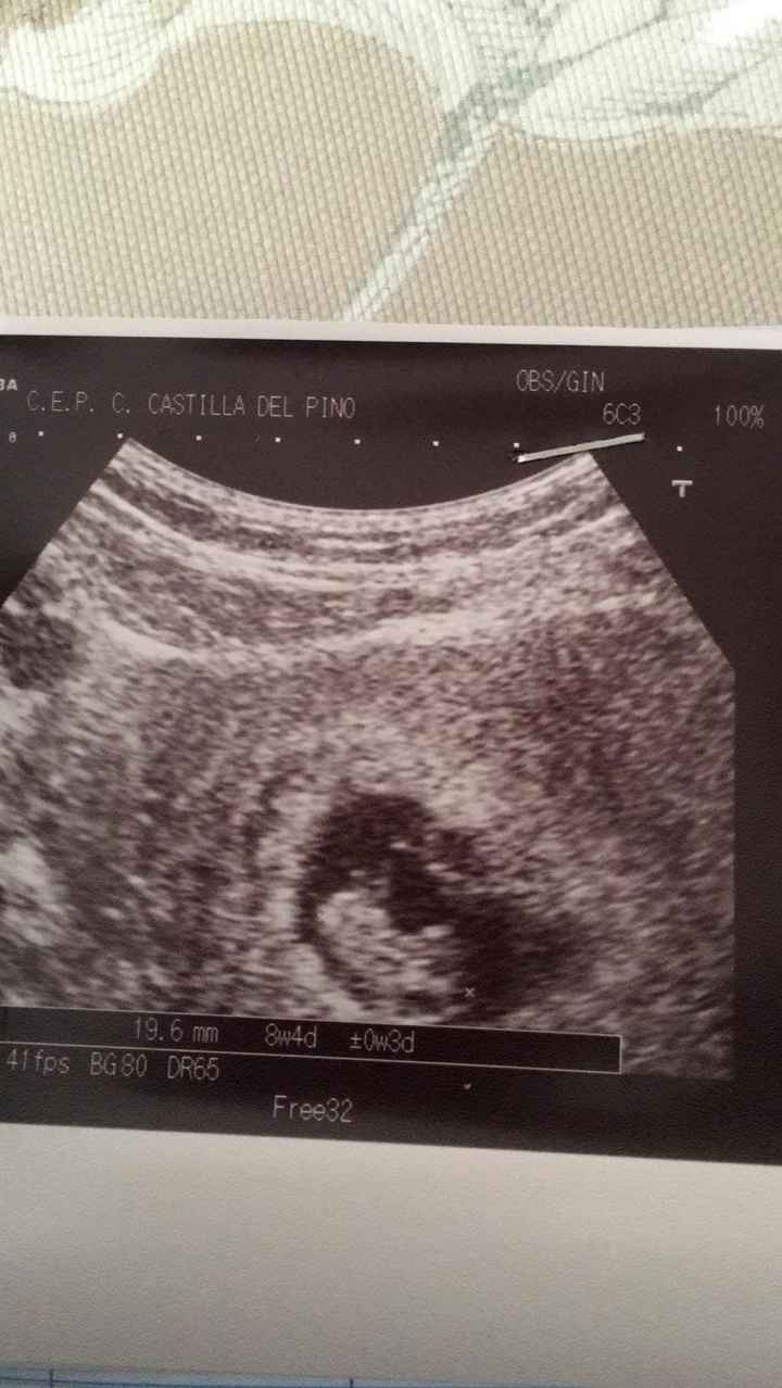 8+3 semanas