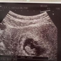 8+3 semanas