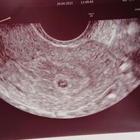 Futuras mamás Diciembre 2022 🤰🏼 ❤️ - 1