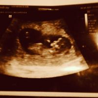 Ayuda con método ramzi: niño o niña? - 1