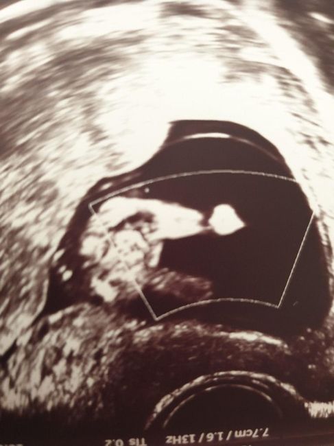 Futuras mamas noviembre 2020 - 1