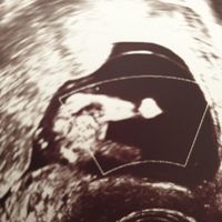 Futuras mamas noviembre 2020 - 1