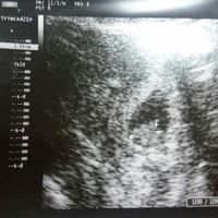 Futuras mamás agosto 2019 - 1