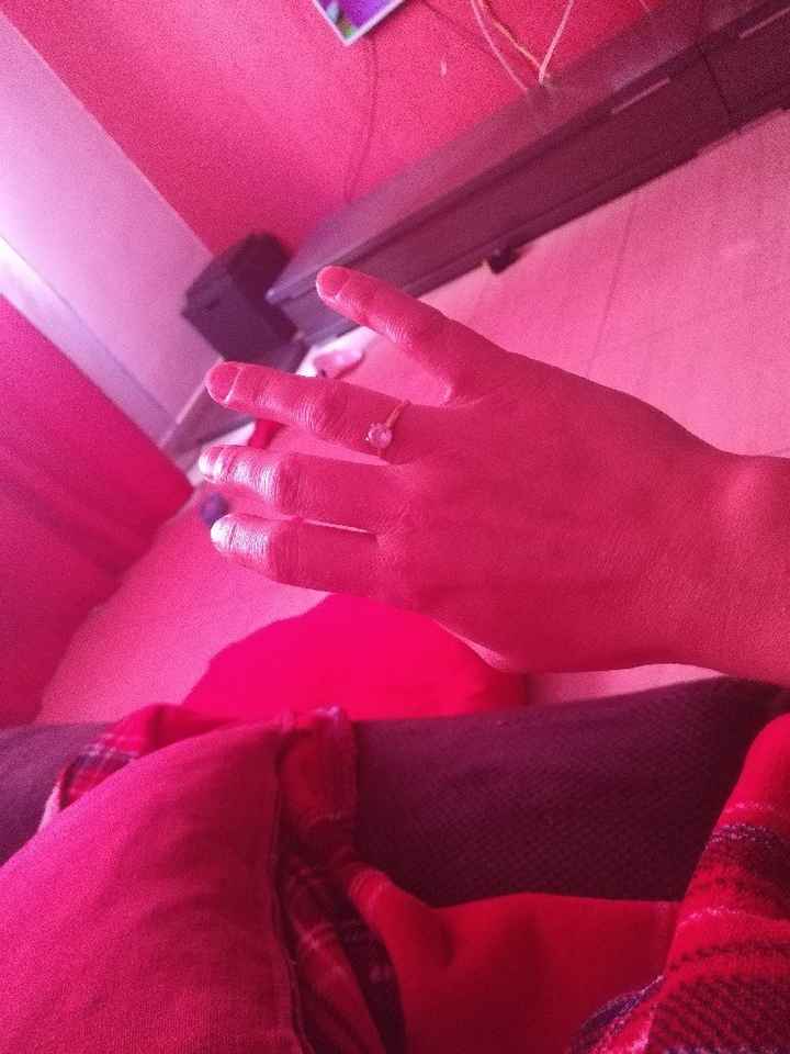 Anillo de compromiso: ¿A o B? - 1