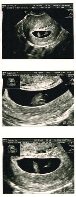 mi nino/a 7 semanas