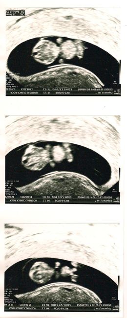 mi nino/a a 9 semanas