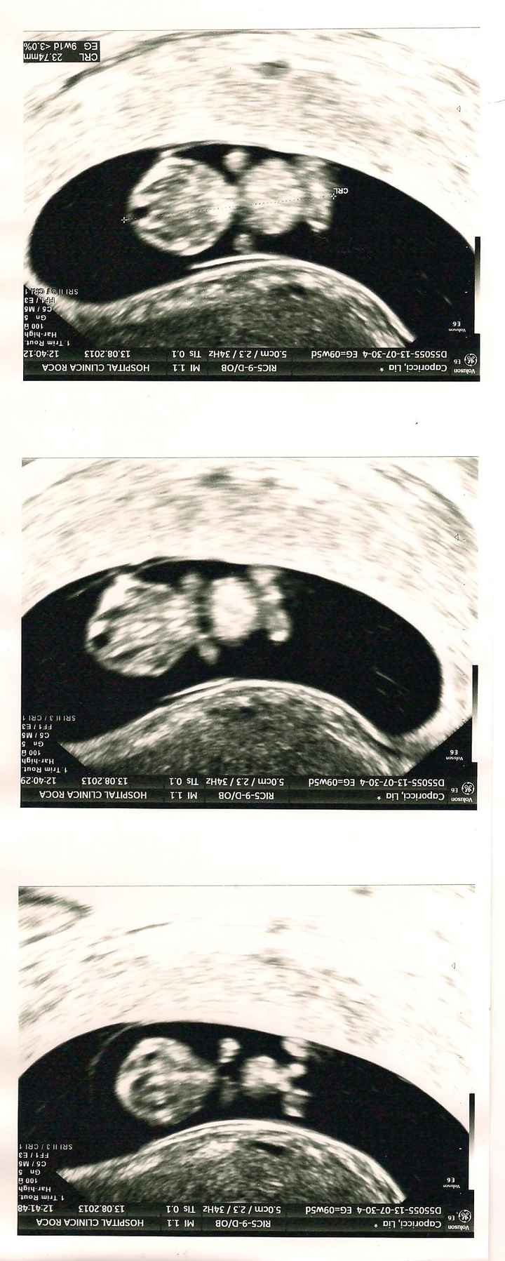 mi nino/a a 9 semanas