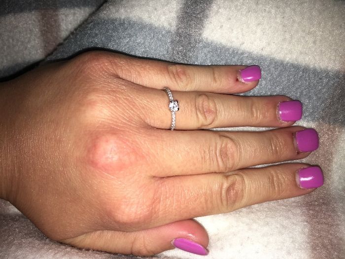 Anillo definitivo