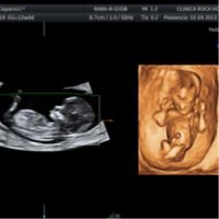 12 semanas