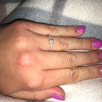 Anillo definitivo