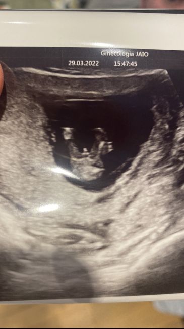 Futuras mamás Octubre 2022 🤰♥️ 1