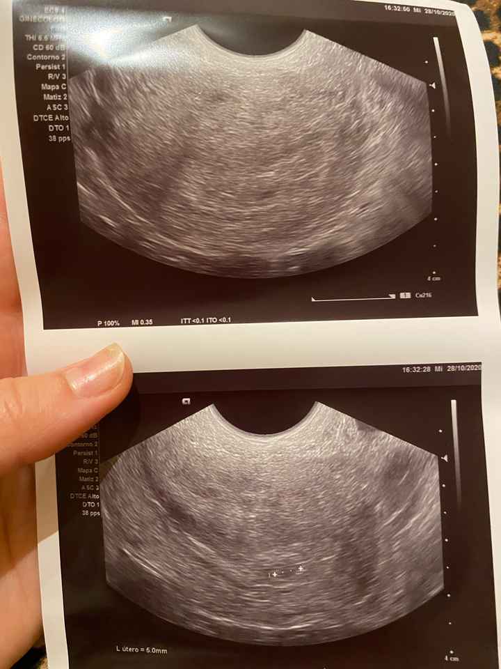 Futuras mamás julio 2021🤰🌹😍😍 - 1