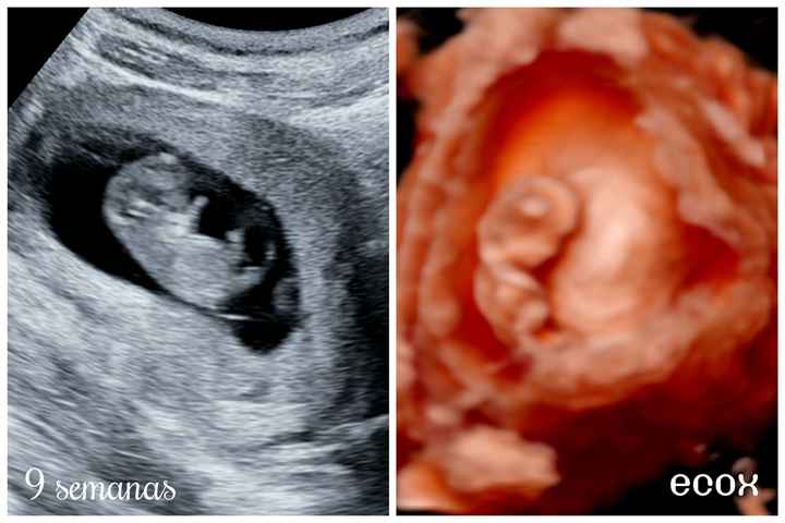 Futuras mamás julio 2021🤰🌹😍😍 - 1