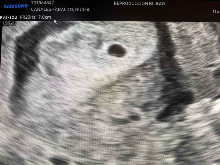 Futuras mamás febrero 2025 - 1