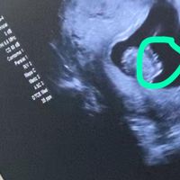Futuras mamás julio 2021🤰🌹😍😍 - 1