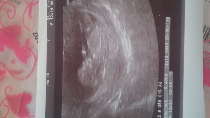 Mamas agosto 2015 - 1