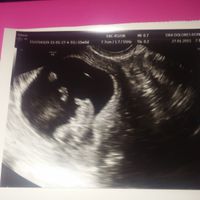 El consultorio de Lita para futuras mamis - 2