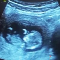 Ayuda con método ramzi: niño o niña? - 1