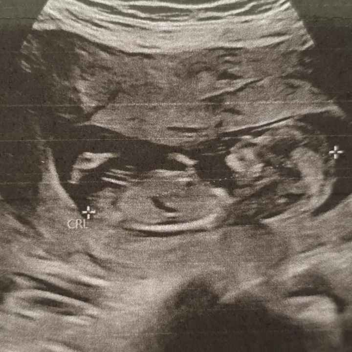Futuras mamas septiembre 2021🤰🤱 - 1