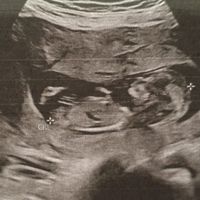 Futuras mamas septiembre 2021🤰🤱 - 1
