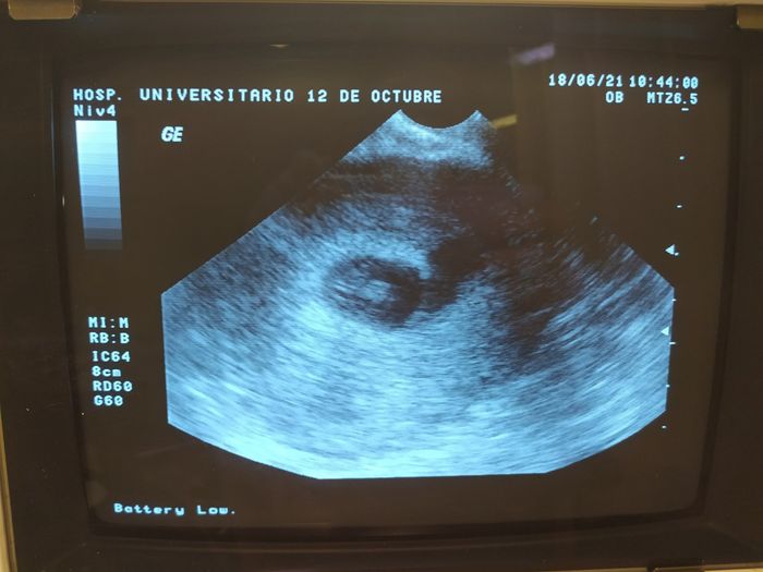 Futuras mamis Enero 2022 - 1