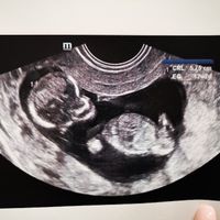 Futuras mamás Junio 2020 - 1
