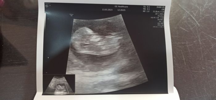 Futuras mamás septiembre 2023?? 2