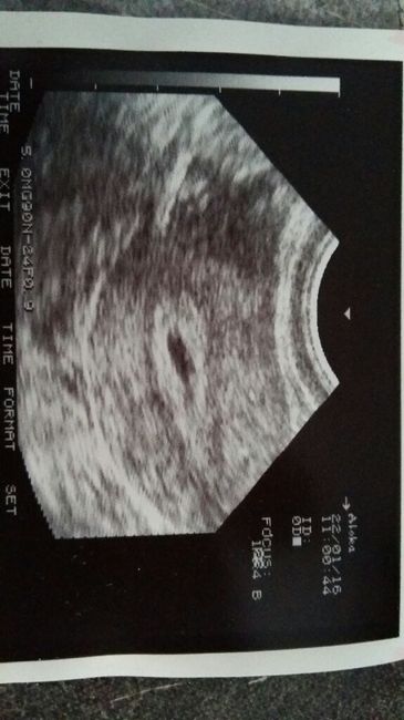 Futuras mamas septiembre 2016 - 1