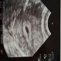 Futuras mamas septiembre 2016 - 1