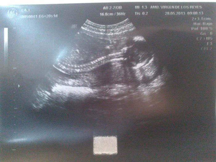 nuestro pequeñín de casi 20 semanas
