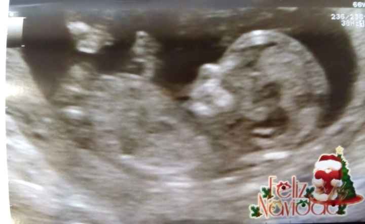 Futuras mamas julio 2016 - 1
