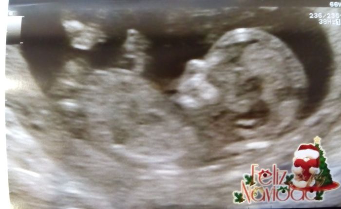 Futuras mamas julio 2016 - 1